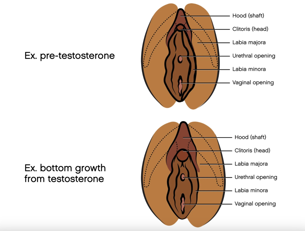 Illustration showing differences between pre and post bottom growth. The first is from before taking testosterone, the second is from after. Both images label the Hood (shaft) and Clitoris (head) at the top and then label labia majora, urethral opening, labia minora, and vagina opening. The Hood (shaft) and Clitoris (head) are remarkably larger in the lower illustration.